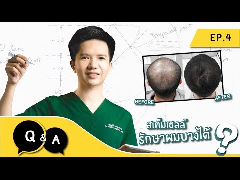 วีดีโอ: ศีรษะล้านแบบในแมว