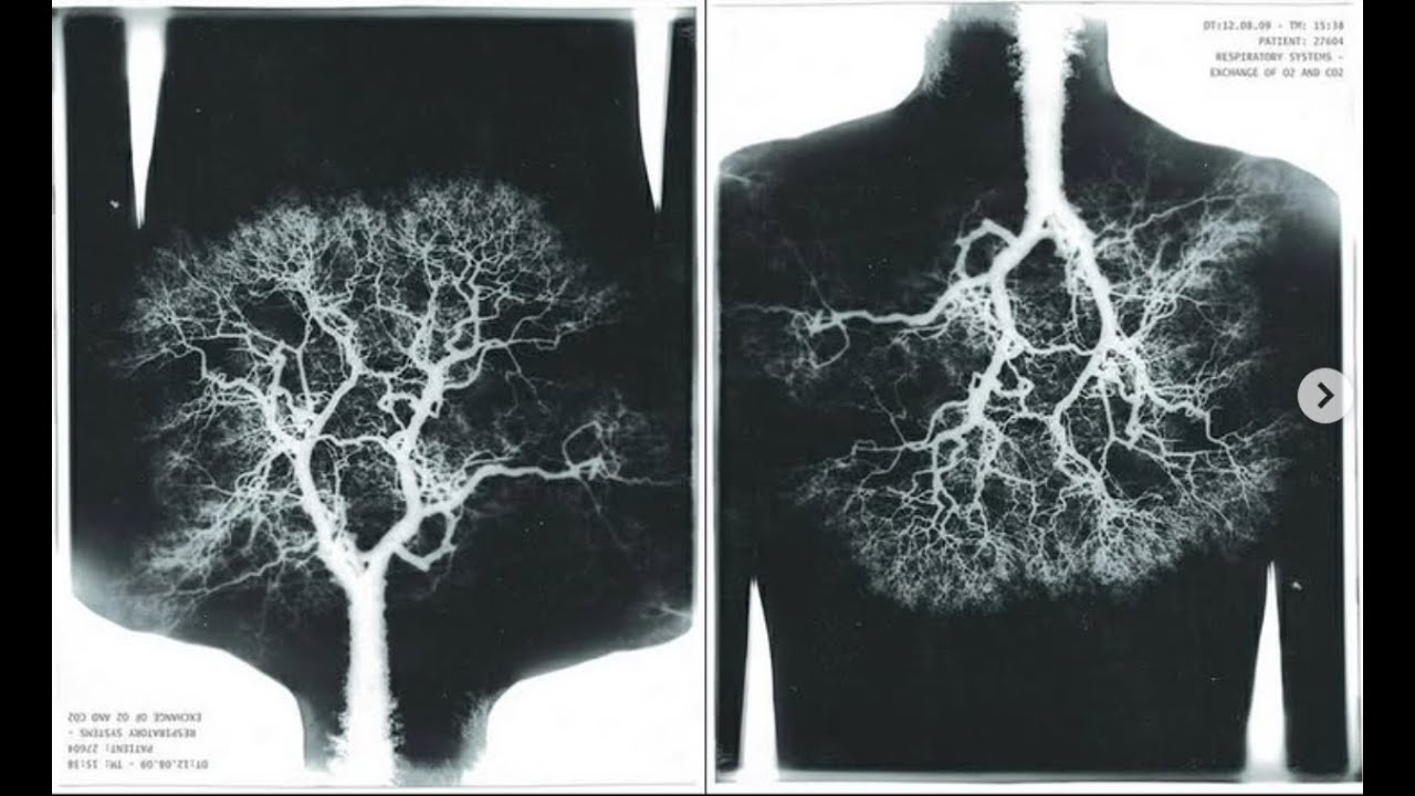 Sato-ri No Shi (Death in Enlightenment) / An Obituary for David Lynch