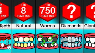 Comparison: Different Types Of Teeth by WatchData 57,778 views 1 month ago 3 minutes, 3 seconds