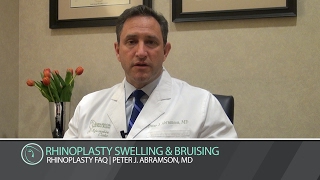 Swelling And Bruising After Rhinoplasty
