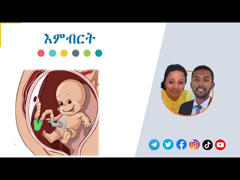 ቪዲዮ: የእምብርት ብርቱካናማ ዛፎች፡እንዴት እምብርት ብርቱካንን ማደግ እንደሚቻል