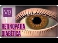 Retinopatia Diabética - Você Bonita (13/09/16)