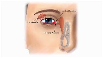 Tecnologia Axion MSR
