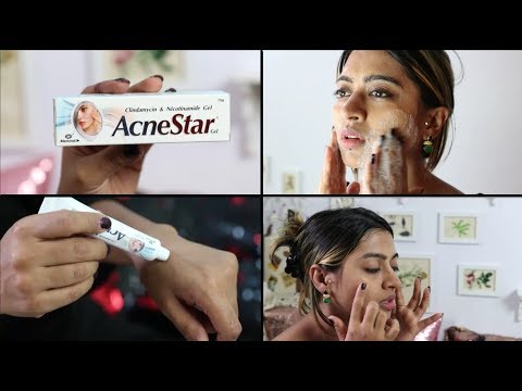 Acnestar Gel Review _ HOW TO REALLY GET RID OF ACNE | SuperWowStyle Prachi