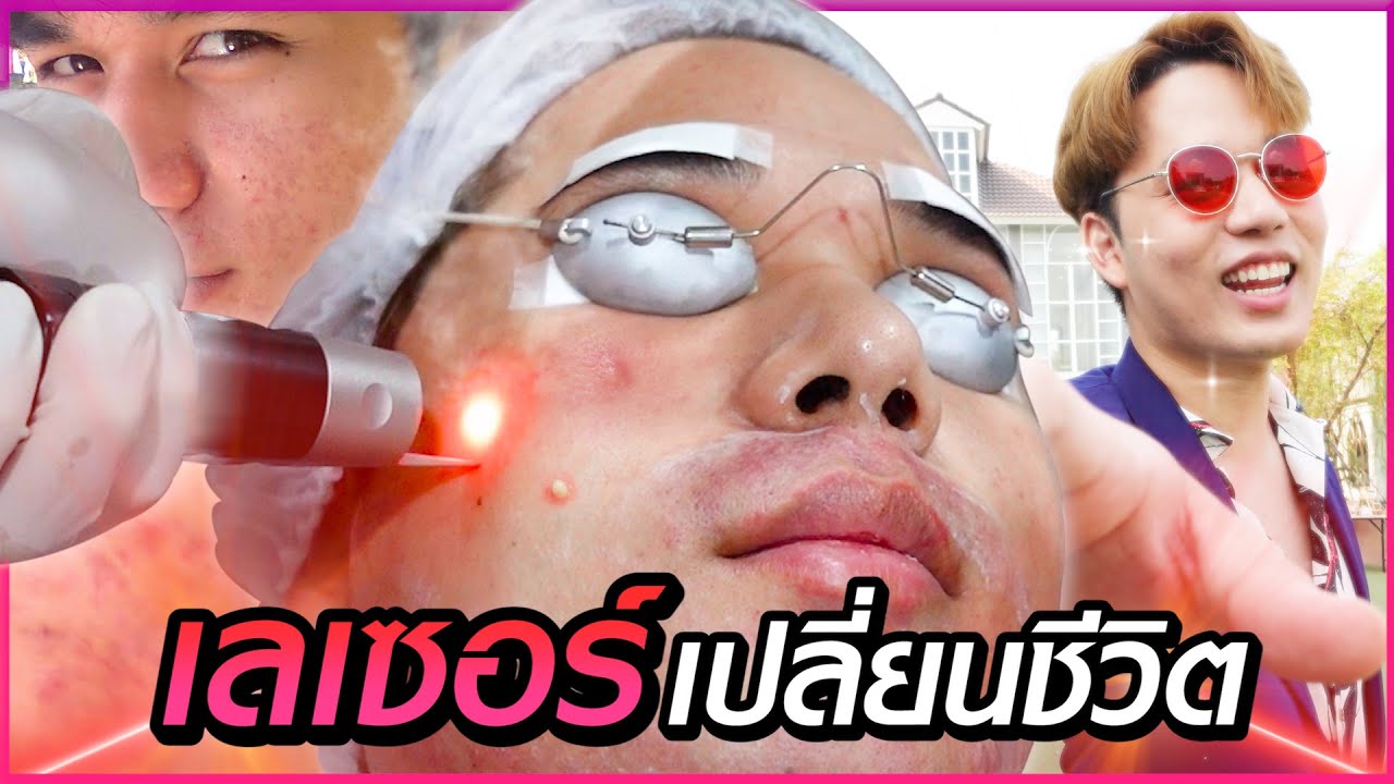 แผนกู้หลุมสิว 4 เดือน เปลี่ยนคนหน้าเถื่อนให้เหมือนเกิดใหม่