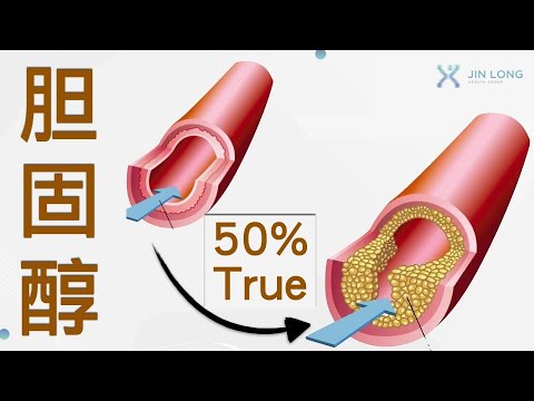 胆固醇，真的有好跟坏之分？好胆固醇 vs 坏胆固醇