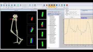 Gait analysis with bluetooth inertial sensors