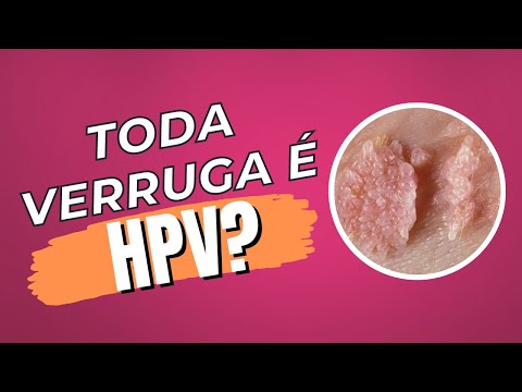 Vídeo: Fazer ruga é sempre câncer?