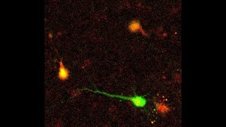 Biomarker Optimized Convolutional Neural Networks