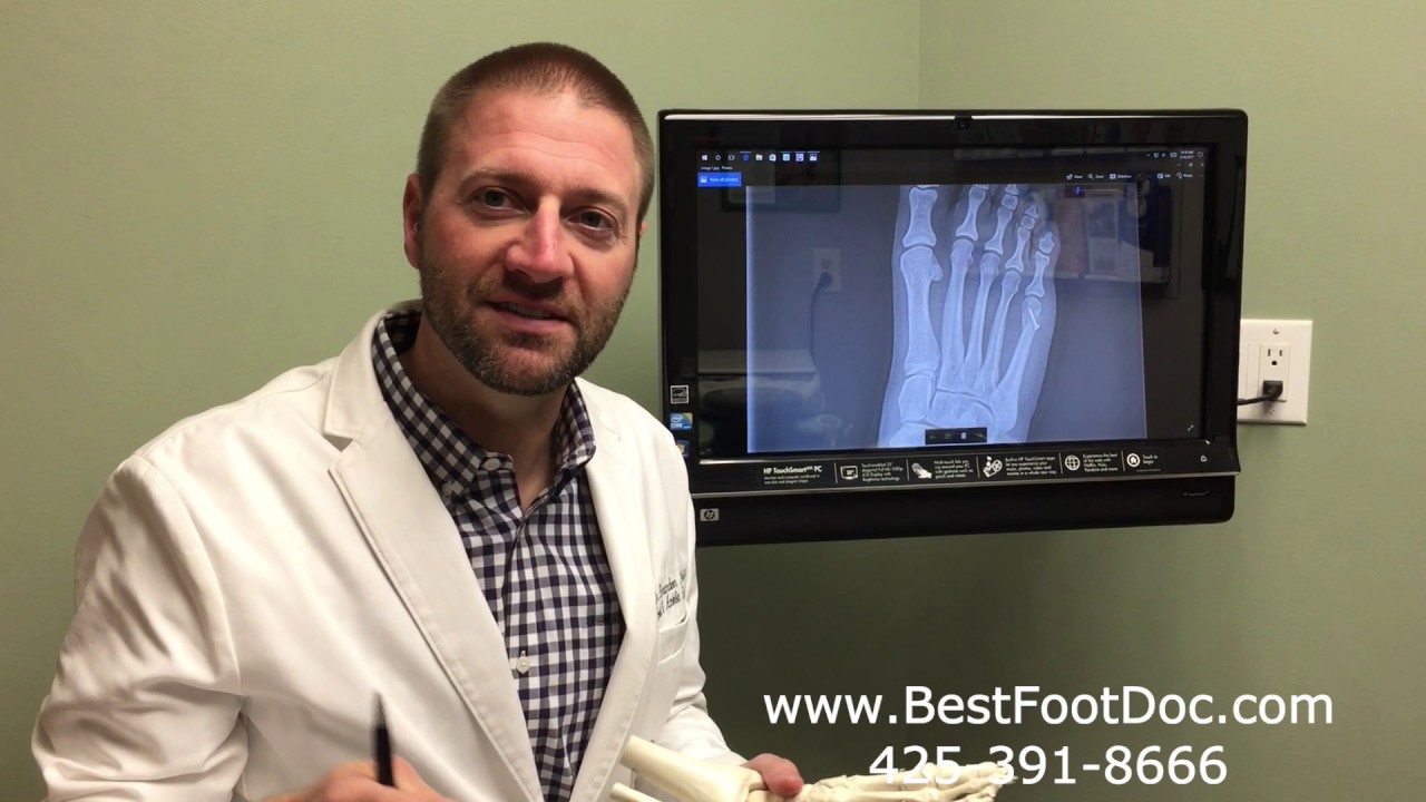 Tailor's Bunion Treatments and Information YouTube