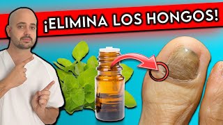 ¡Elimina HONGOS en las UÑAS en 1 DÍA! || 10 REMEDIOS NATURALES para HONGOS en las UÑAS