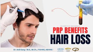 Control Hair Fall with PRP Treatment |  Before & After Result | Benefits of PRP