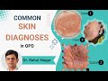 Common skin diagnoses in opd