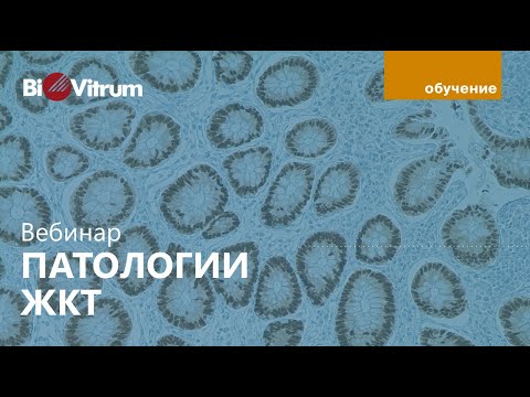 Патологии ЖКТ: виды злокачественных новообразований и использование иммуногистохимических маркеров