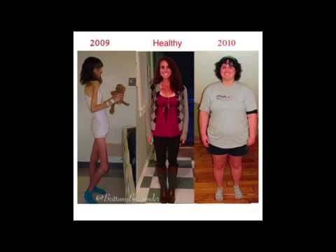 My Shocking Eating Disorder Story From 56 To 221 Pounds Video Author Brittany Burgunder My Shocking Eating Disorder Story From 56 To 221 Pounds Video Author Brittany Burgunder
