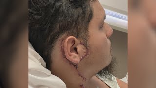 Rockford man seeks medical bill help after being shot in 'road rage' incident