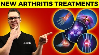Top 10 New Arthritis Treatments! [Osteoarthritis & Rheumatoid)