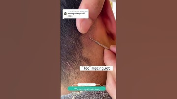 Giải quyết tóc mọc ngược