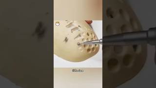 The Brain Surgery Blade That Cuts Skull, Not Brain 🤯 #shorts #brain #fpy