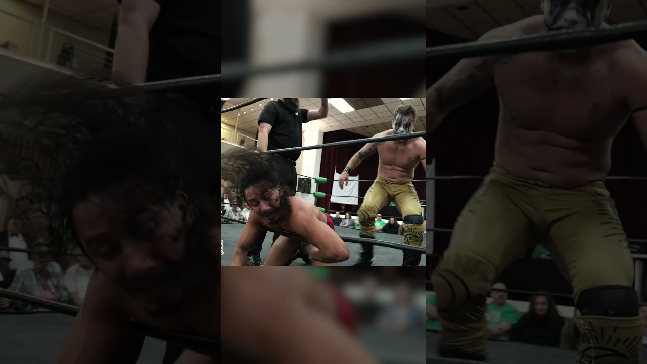 Mike Skyros Is Cold-Blooded As He Works Over Gabriel Skye’s Arm! 