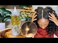 ⚠️ CAUTION!! DO NOT MAKE THIS IF YOU ARE NOT READY FOR EXTREME HAIR GROWTH &amp; HAIR LOSS RELIEF