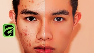 How I Retouch Skin Flawlessly in Affinity (Beginner Friendly )