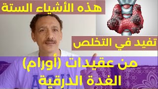 هذه الأشياء الستة تفيد في التخلص من عقيدات (أورام) الغدة الدرقية