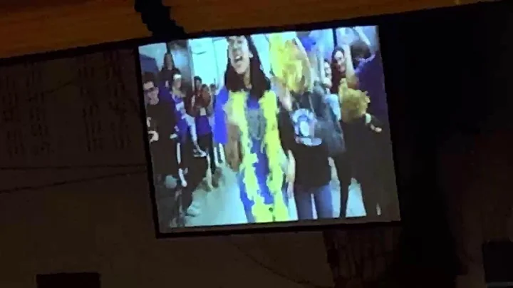 RHS Lip Dub Assembly