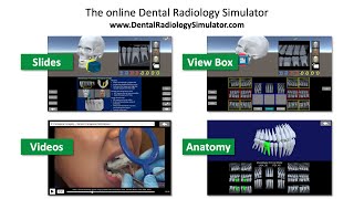 Dental Radiology Simulator demo screenshot 5
