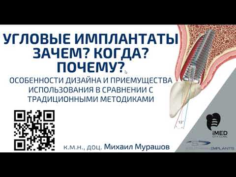 Угловые имплантаты. Зачем, когда, почему?