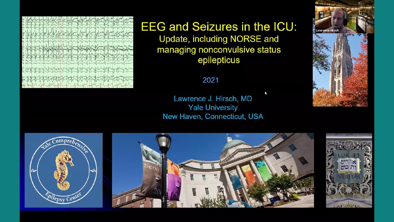 Lawrence Hirsch, MD. EEG and Seizures in the ICU, NORSE and managing non-convulsive status.