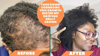 Edge growth, best hair growth water, take down cornrows after one month, best way to detangle hair