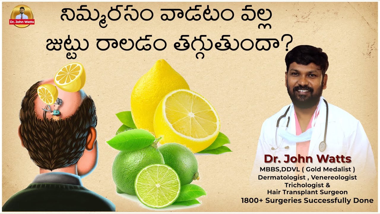 నిమ్మరసం వాడటం వల్ల జుట్టు రాలడం తగ్గుతుందా? | Dr.John Watts