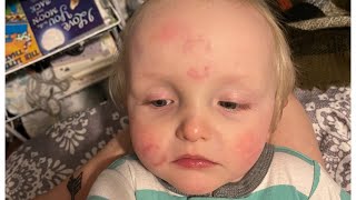 'He had bite marks all over' | Clayton Co. daycare now under investigation