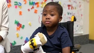 Meet Zion, the first child to get a double hand transplant