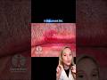 Did you know you can get skin cancer HERE?
