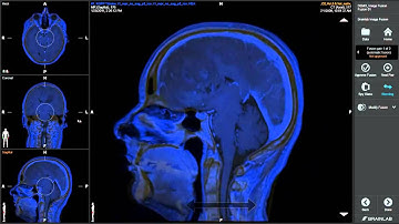 Intelligent Pre Calculated Image Fusion