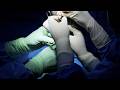 Advanced ZSR Circumcision with Bilateral Varicocele Ligation Grade 3 & 4 | Full Procedure | Kannada