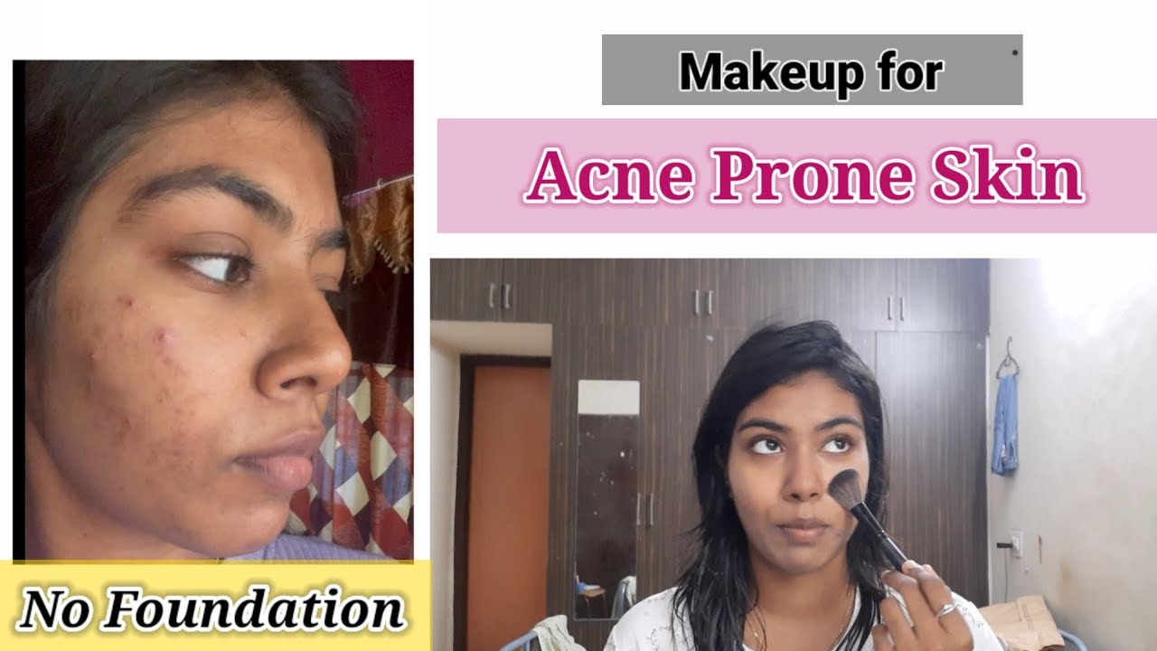 makeup for Acne Prone Skin *WITHOUT ANY SIDE EFFECTS* || college and ...