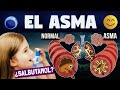 TODO SOBRE ASMA | SINTOMAS, DIAGNOSTICO Y TRATAMIENTO