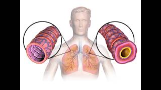 CRT to RRT Practice Session 5 30 26