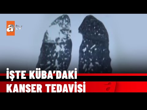 Video: Kolloidal gümüşü nasıl saklarsınız?