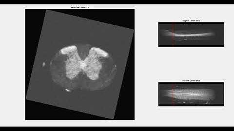 Magnetic resonance microscopy of mouse spinal cord and hippocampus