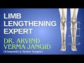 Limb lengthening expert  dr arvind verma jangid