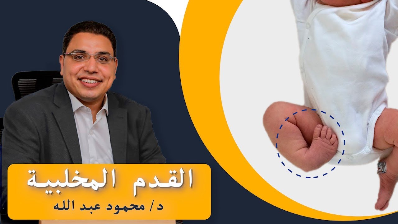 أسئلة عن القدم المخلبية 🦶 بتدور في ذهن الآباء والأمهات