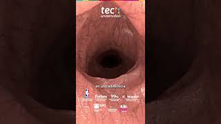 Anatomía Vulvar En Ginecología Estética Y Funcional ❘ Tech Universidad