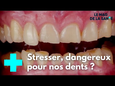 Vidéo: Les Déviations Mentales Seront Déterminées Par Les Dents - Vue Alternative