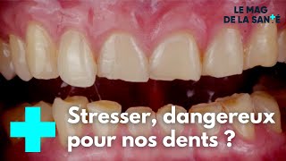 Stress : quel impact sur nos dents ? - Le Magazine de la Santé