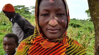 Help Monica heal from Leprosy and care for her 2 young children.