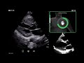 Vscan Air™ | Caption AI™ Quality Meter, AutoCapture and Save Best Clip